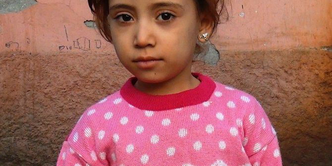 Minik Renim’in Yaşaması Almanya’da Bulunan İliğin Getirilmesine Bağlı