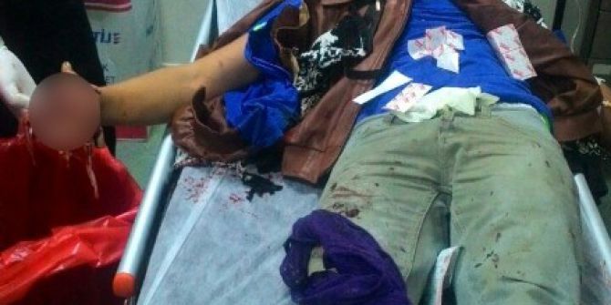 Polise Atmak İstediği Bomba Elinde Patladı