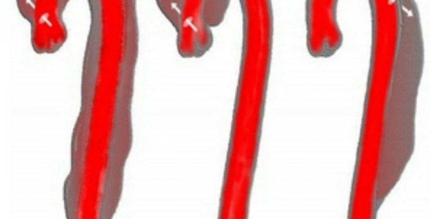 Çalıştığı Hastanede Hayata Tutundu