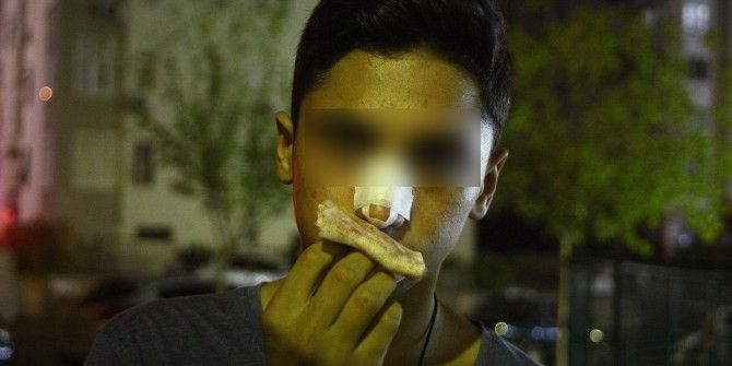 Babasının Dövdüğü Kızı Teselli Eden Çocuğun Burnunun Kırıldığı İddiası