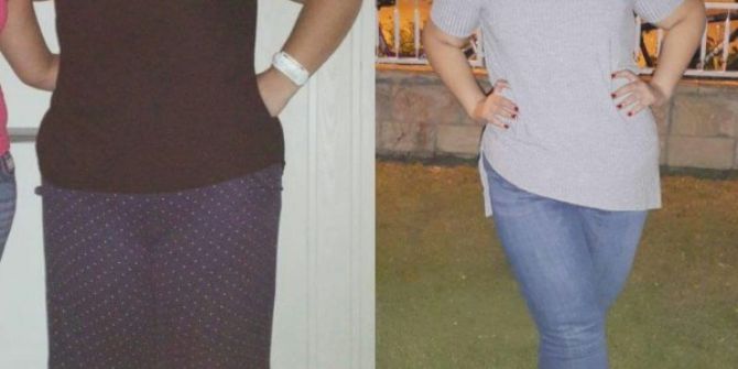 57 Kilo Verdi Hayatı Değişti