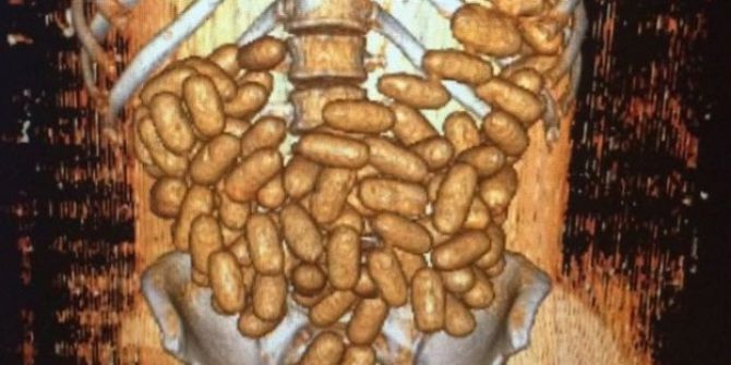 Sindirim Sistemlerinden Uyuşturucu Çıktı