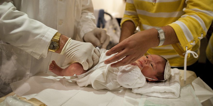 Çocukları 3 İle 5 Yaşları Arasında Sünnet Ettirmeyin