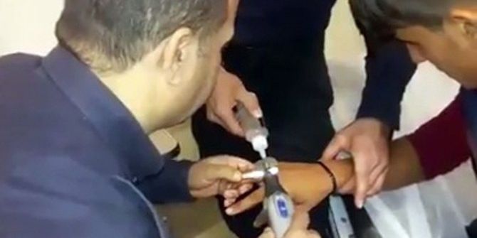 Parmağına Sıkışan Yüzük İtfaiye Tarafından Çıkartıldı