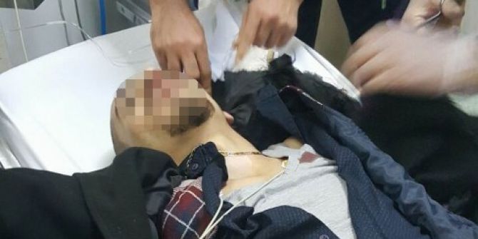 Silahlı Saldırıda Ağır Yaralandı
