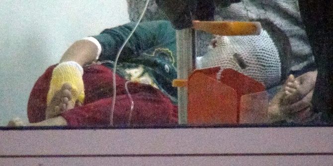 Akıma Kapılan Boyacı, 8 Yaşındaki Çocuğu Da Yaktı