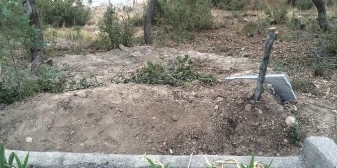 Türkiye’nin Yüzlü Nakli Yapılan İlk Kadını Son Yolculuğuna Uğurlandı