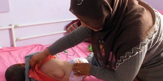 Annesinin Terk Ettiği 5 Yaşındaki Engelli Mirhan’a Babaannesi Bakıyor