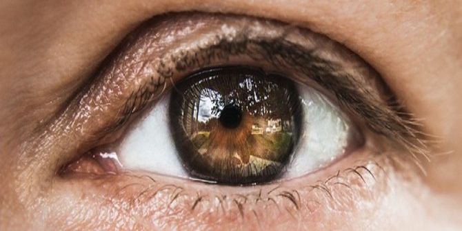 Gözde Işık Çakmasına Dikkat