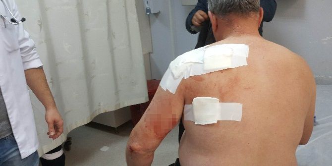 Eniştesinin Bıçaklı Saldırısına Uğradı