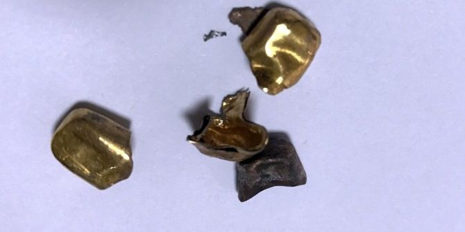 Kuyumcuya Sahte Altın Diş Satmaya Çalıştı