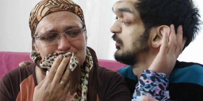 İnsanların Bakışından Rahatsız Oldu, Sanatla Hayata Tutundu