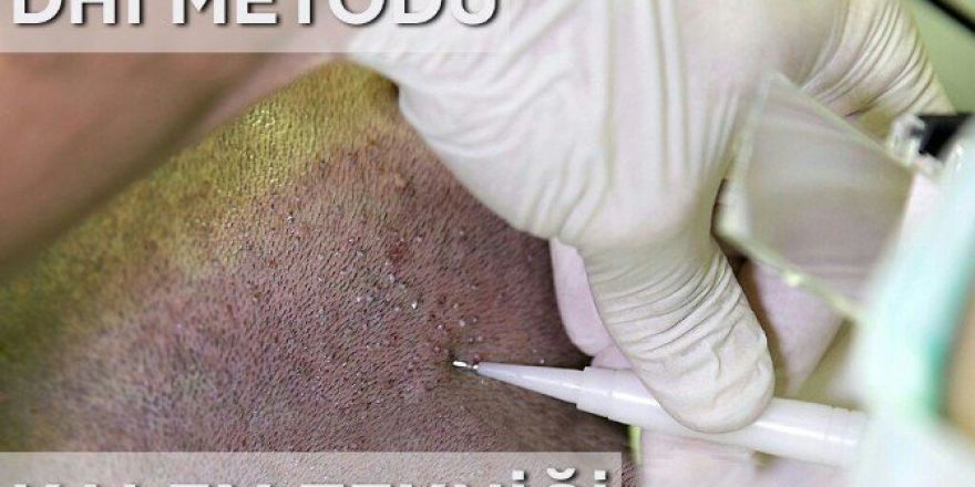 Daha Sık Saçlar İçin Kalem Tekniği