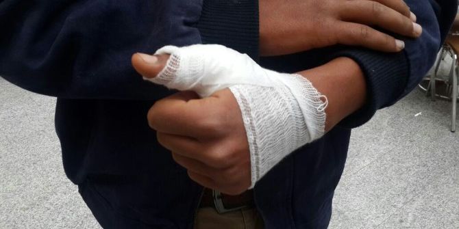 Köpeğin Saldırdığı Suriyeli Genç Yaralandı