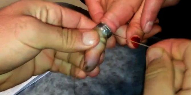 İtfaiyeden Yüzük Operasyonu