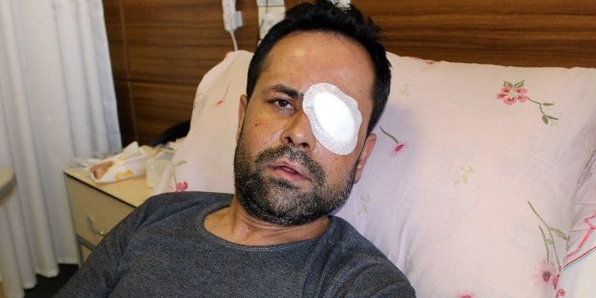 Servisi Beğenmeyen Müşteri Garsonu Gözünden Etti