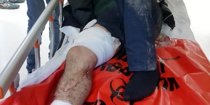 Samsun’da Silahlı Saldırı: 3 Yaralı