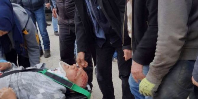 Bisiklet İle Otomobil Çarpıştı: 1 Yaralı