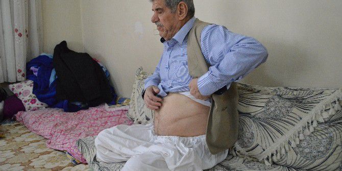 45 Yıllık Sigara Bağımlısının İbretlik Hikayesi