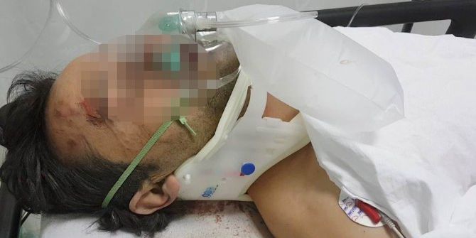 Darp Edilen İnşaat İşçisi Ağır Yaralandı