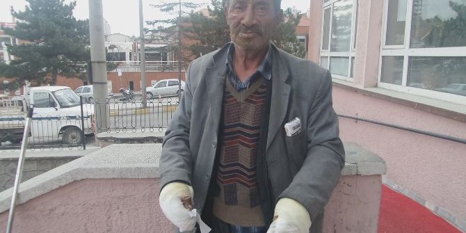 Su Yerine Benzinle Sobayı Söndürünce Ölümden Döndü