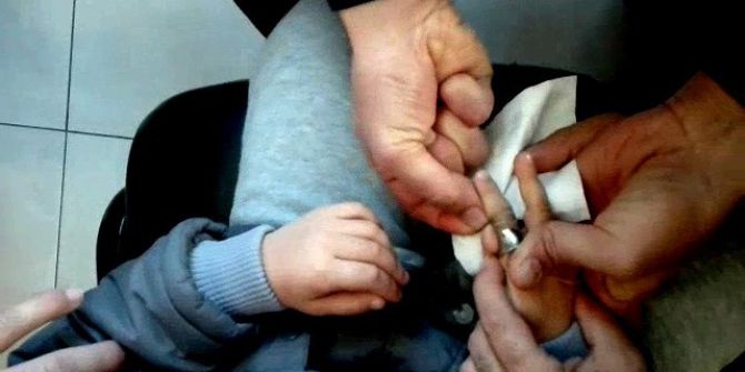 Demir Halkaya Sıkışan Parmağına İtfaiye Müdahale Etti