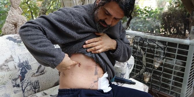 Bıçaklandığı Anı Kameraya Çekti