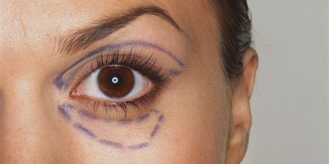 Yorgun Görünümlü Gözlerden Kurtulun