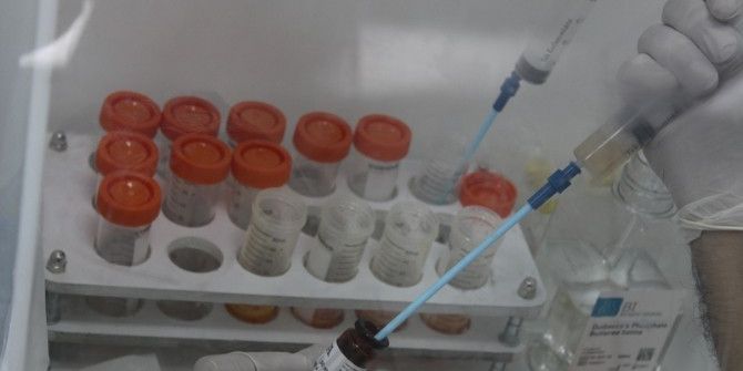 Diyabete Bağlı İyileşmeyen Yaralara "Kök Hücre" Tedavisi