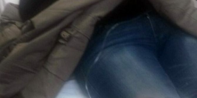 Barışmaya Çağırdığı Eski Eşini Bacağından Vurdu