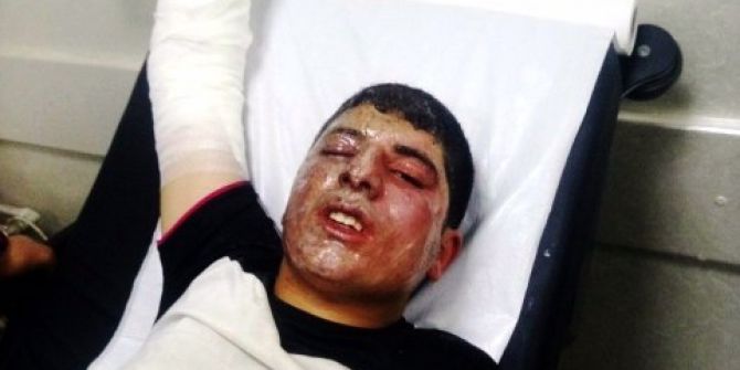 Dicle Elektrik’ten ’Trafolara Müdahale Etmeyin’ Uyarısı