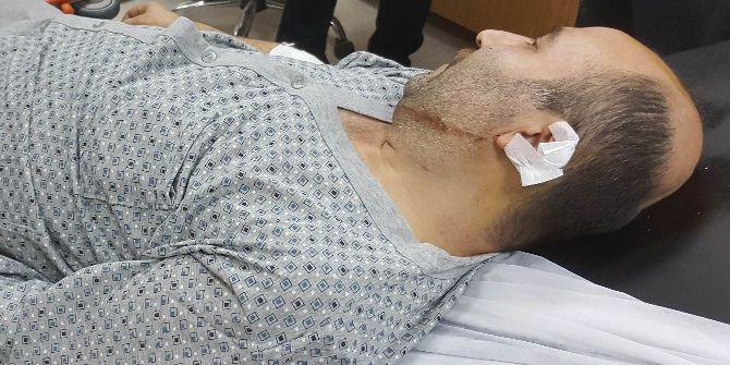 Silahlı Saldırıda Kazara Vuruldu