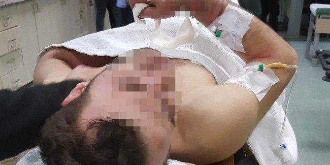 Elektrik Akımına Kapılan Genç Hastanelik Oldu