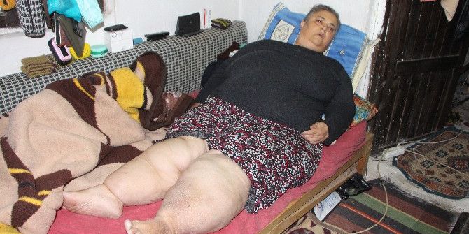 Fethiye’de Fil Hastası Kadının Dramı Yürek Burkuyor