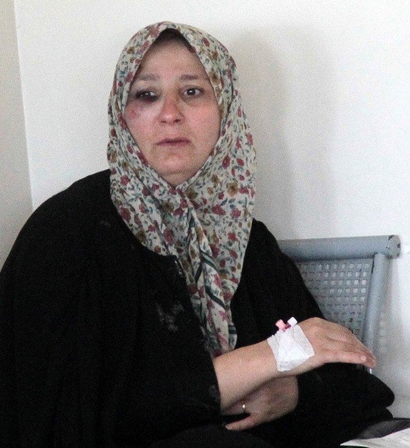 Küpesini Vermeyince Kocası Darp Etti