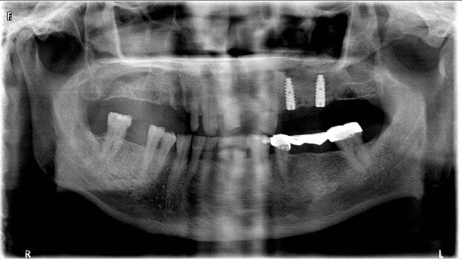 Aydın Ağız Diş Sağlığı Merkezi’nde Bir İlk