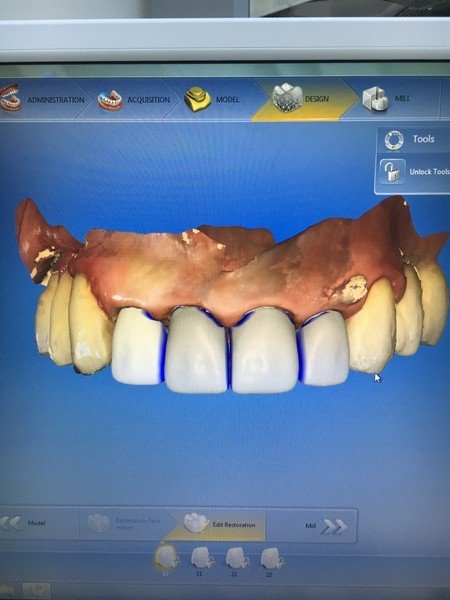 Diş Hekimliği Cad/cam Cihazı İle Hizmet Vermeye Devam Ediyor