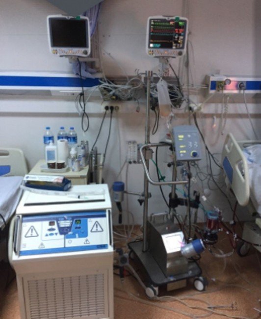 Ecmo Cihazı Onlarca Hayat Kurtaracak