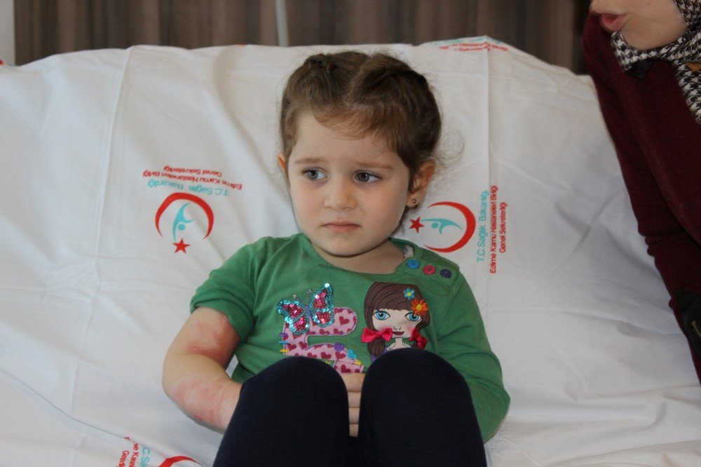 Üç Yaşındaki Rabia’nın Yanık Kolu Kesilmekten Kurtarıldı