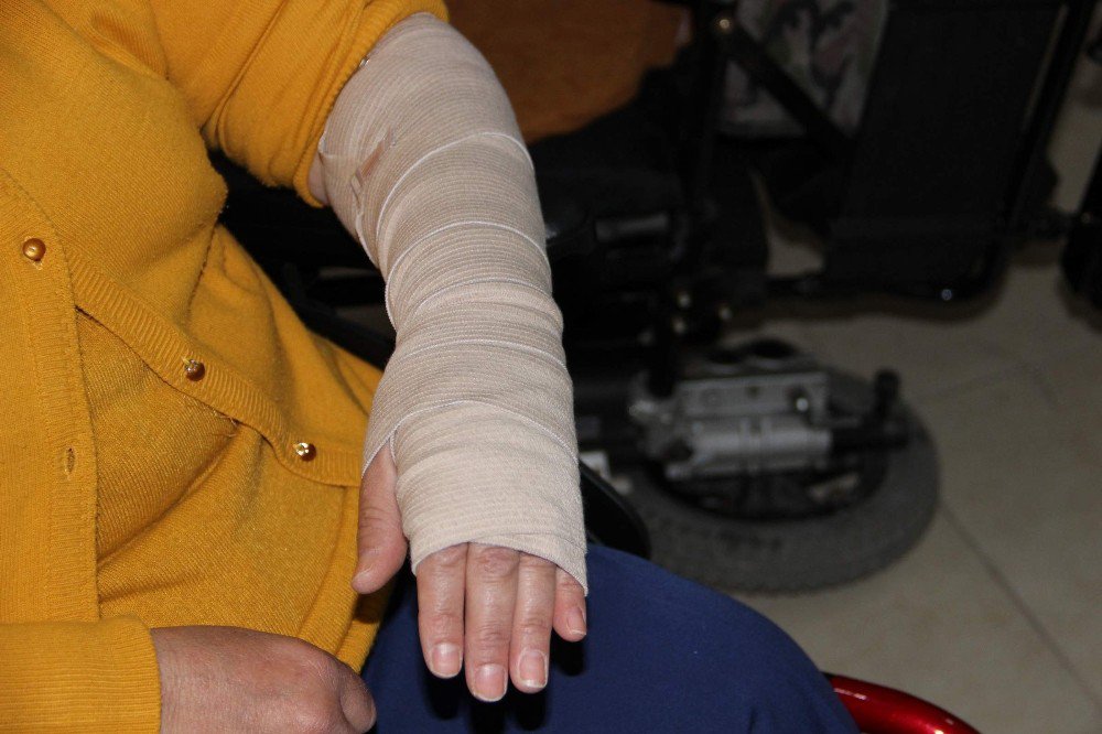 Engelli Kadına Çarpıp Kaçtı