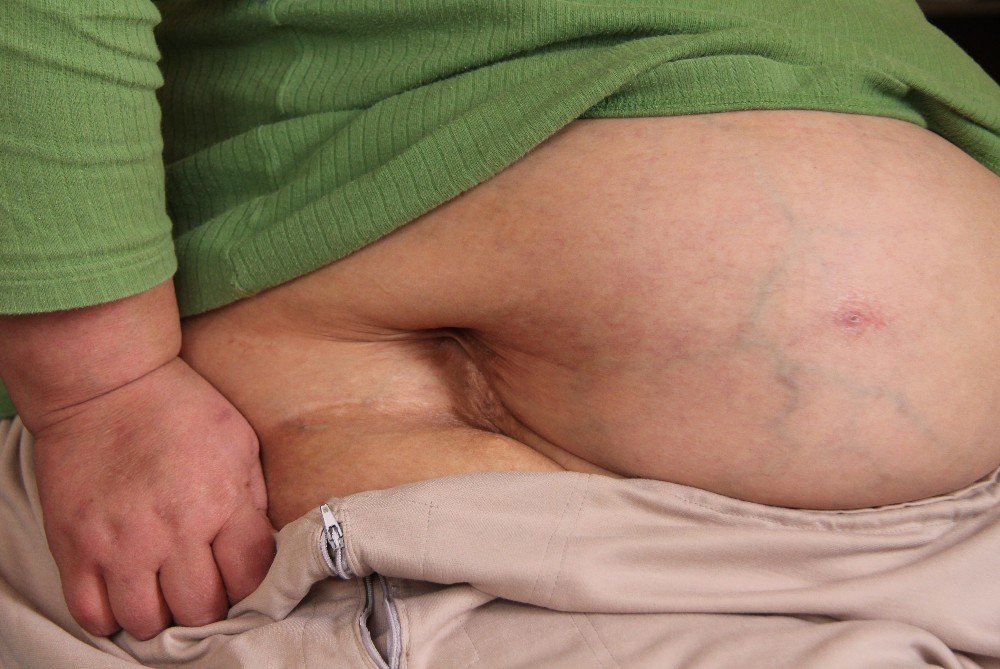 Ayrıldığı Kocası Tarafından 2 Kez Bıçaklanan Kadının Hayatı Karardı