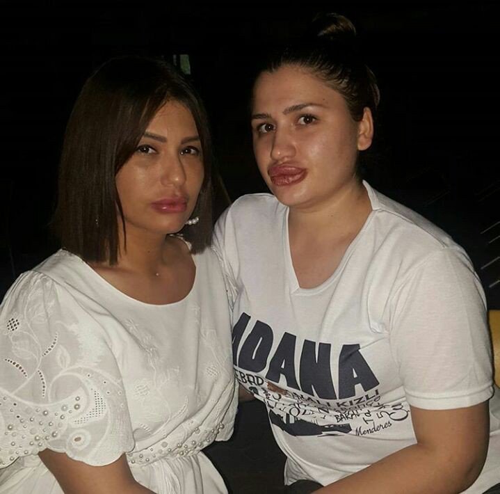 Estetik Mağdurları Buluştu