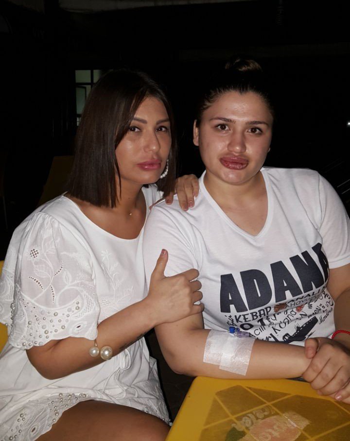 Estetik Mağdurları Buluştu