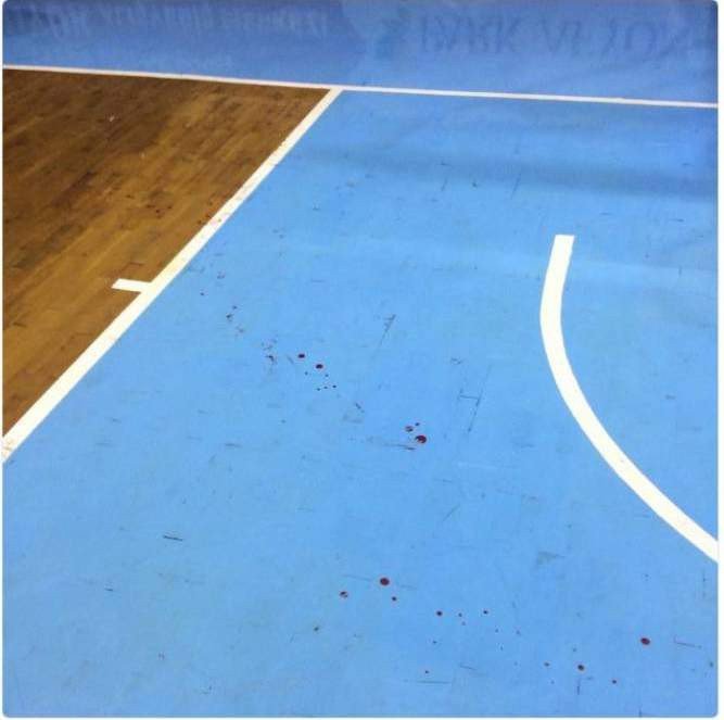 Basketbol Maçında Arbede: 2 Yaralı