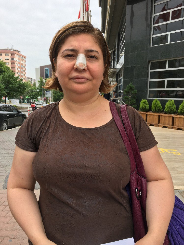 Yanlış Yıkama Ve Kimyasal Yüzünden Saçından Oldu İddiası