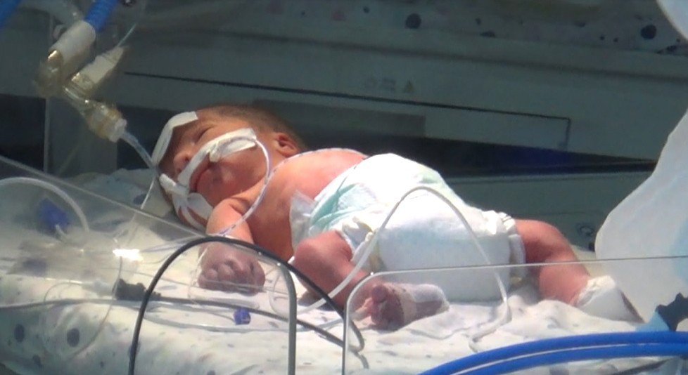 Annesi Öldürülen Bebeğin Hayati Aktivitelerinde İyileşme Var