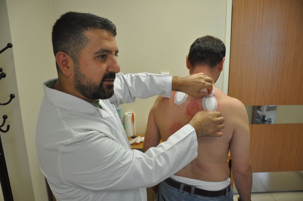 Devlet Hastanesinde Hacamat Ve Akupunktur Polikliniği Açıldı