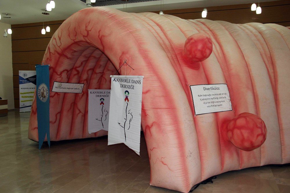 Dev Kalın Bağırsak Maketiyle Vatandaşlar Bilgilendirildi