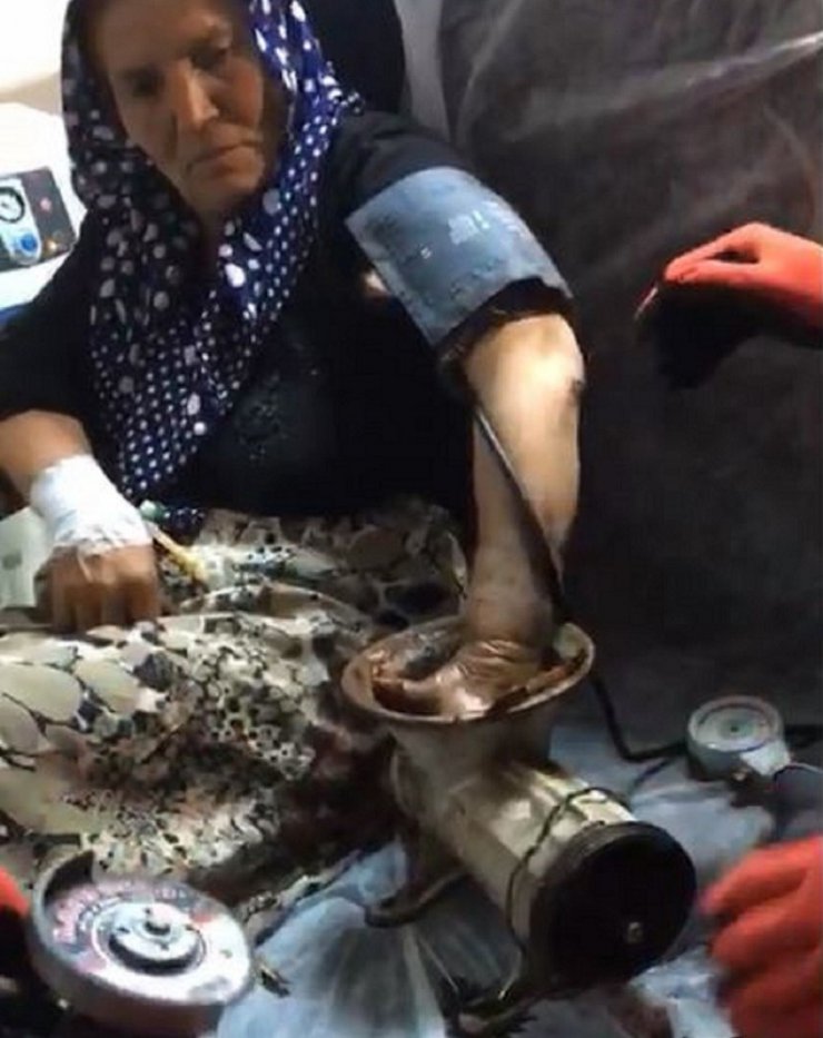 Eli kıyma makinesine sıkışan kadının yardımına itfaiye yetişti