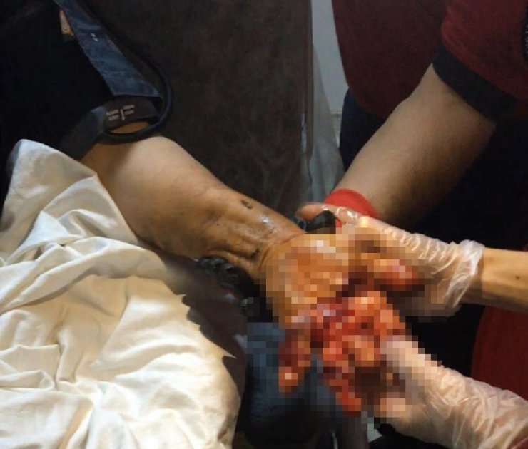 Eli kıyma makinesine sıkışan kadının yardımına itfaiye yetişti